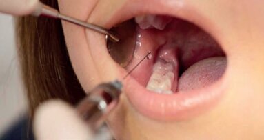 Frustracije zaradi nezadostnega anesteziranja pacientov?