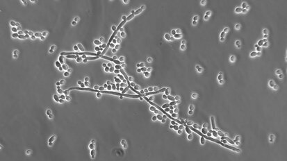 Researchers identify role of mouth cells in Candida infection