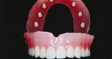 Proteze budućnosti...