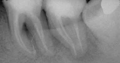 Photon Induced Photoacoustic Streaming