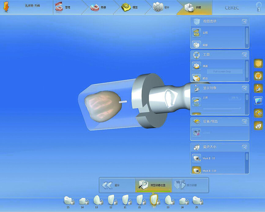 Fig. 18: Designed restoration prepared to mill.
