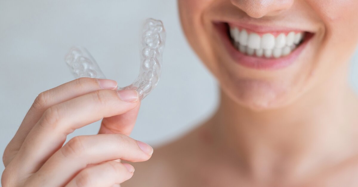 International Delphi study establishes consensus on aligner therapy indications
