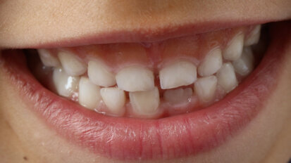 Bank tkanek i komórek obszaru jamy ustnej częścią Mapy Innowacji w ochronie zdrowia