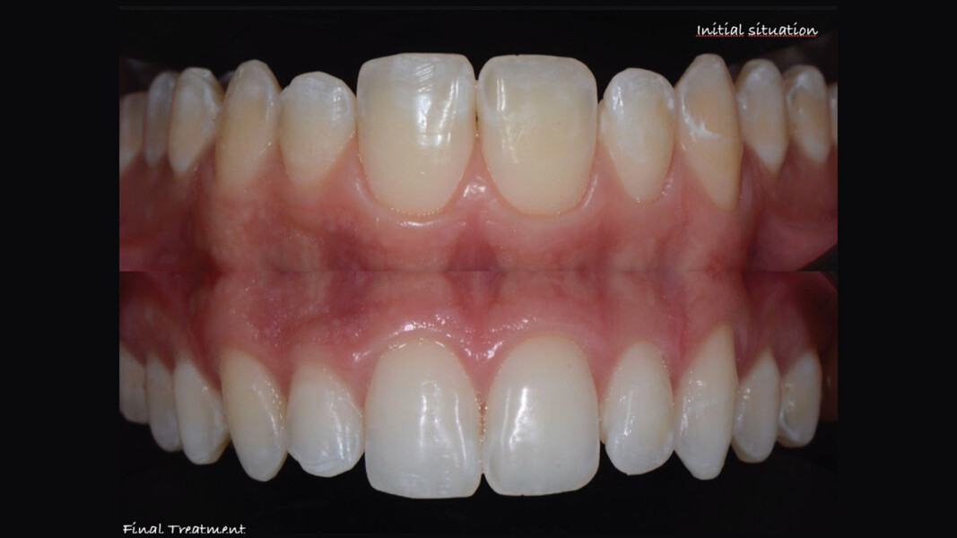 Figg. 12, 13 - Follow-up a 12 mesi.