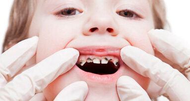 Australia, sotto la lente il sistema di cure odontoiatriche gratuite per bambini