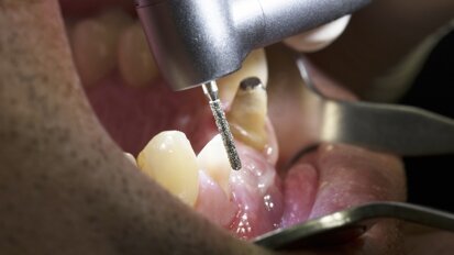 It is all about control It is all about control