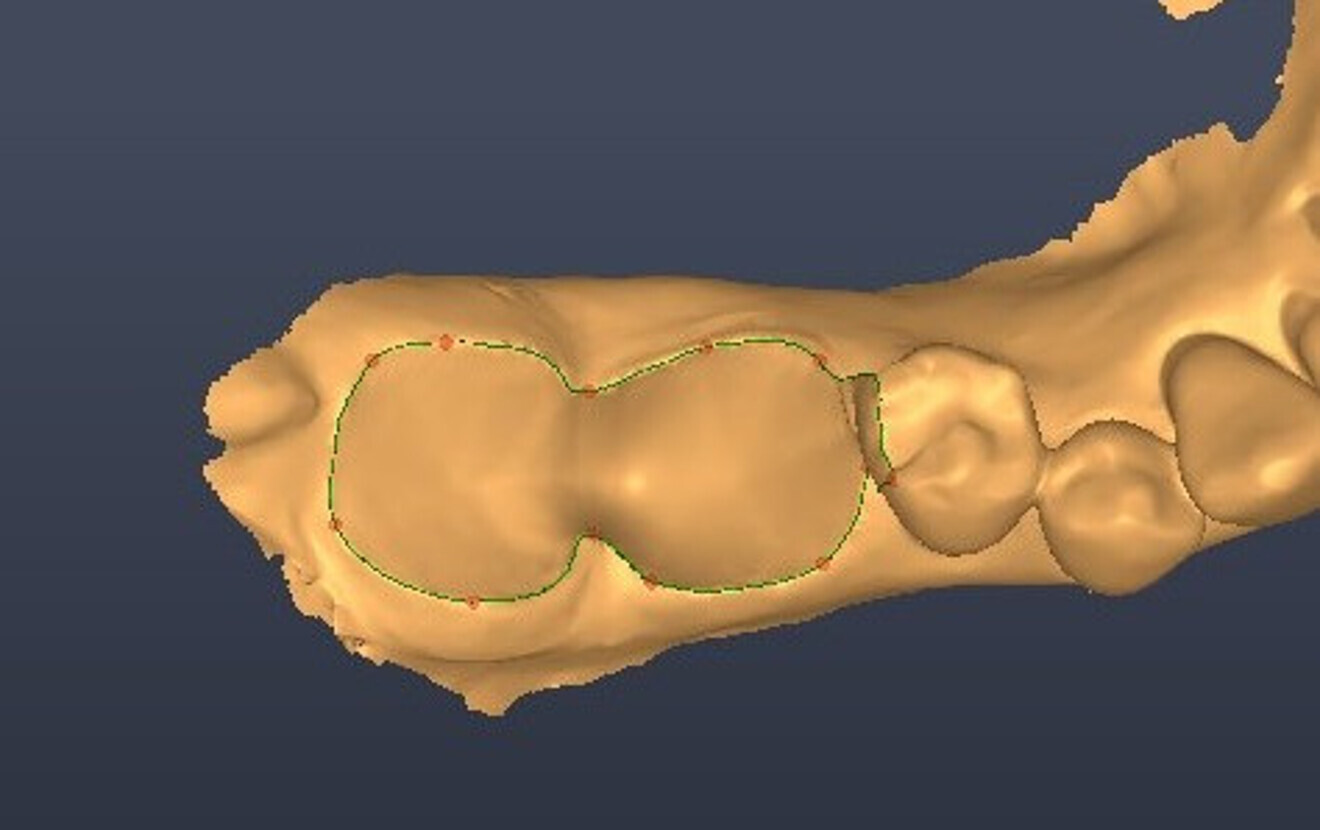 Fig. 3: Virtual extraction.