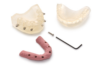 Materialise Dental: eccellente pianificazione a ritroso con Immediate Smile®