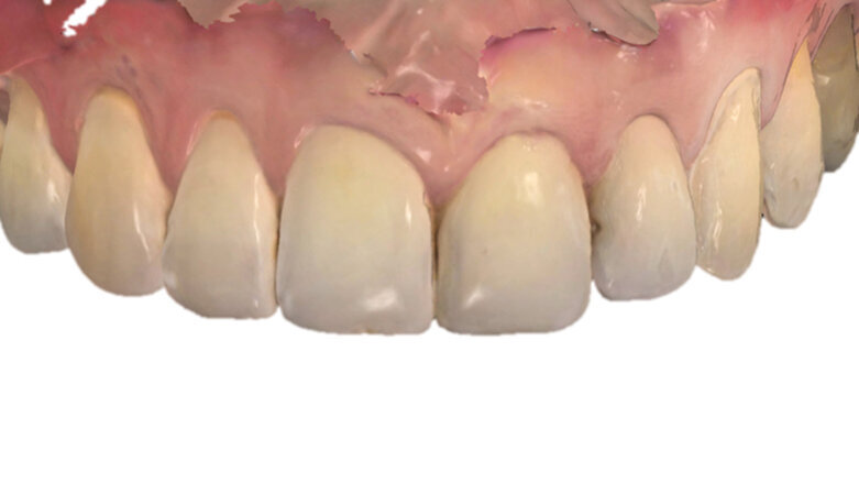 Digitální zubní lékařství v každodenní praxi