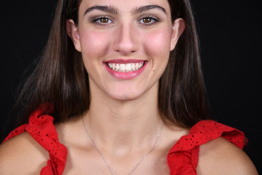 Fig. 30: Post-treatment view.