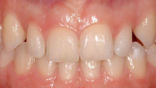 Bioestetica:  un nuovo approccio al miglioramento del sorriso