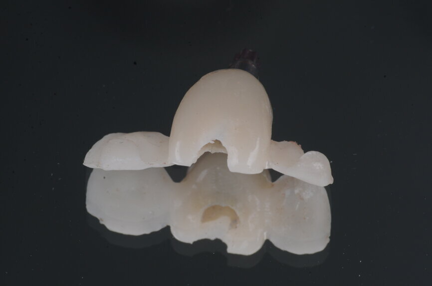 Fig. 24: Screw access open.