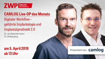 CAMLOG Live-OP am 5. April zum digitalen Workflow CAMLOG Live-OP am 5. April zum digitalen Workflow