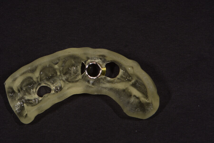 Fig. 11: Same surgical guide with a guide sleeve in place and after sterilising.