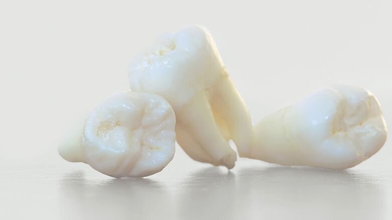 Oplossing voor het tandartstekort in China? De behandelrobot