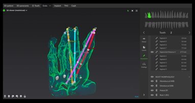 Използване на дигитален софтуер за ефективно лечение на коренови канали