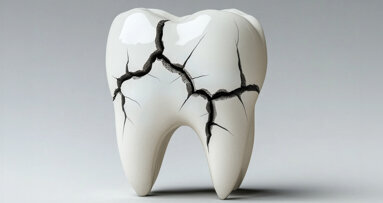 Keine Einigung bei Amalgamersatz: Zahnärztekammer kritisiert ÖGK