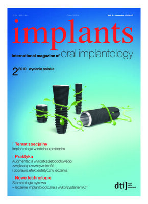 implants Poland No. 2, 2010 implants Poland No. 2, 2010