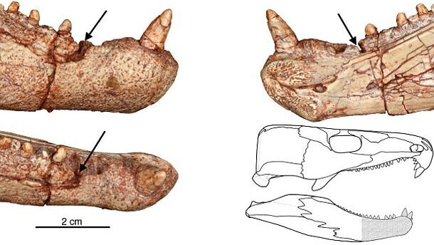 Des chercheurs découvrent le plus vieux mal de dents