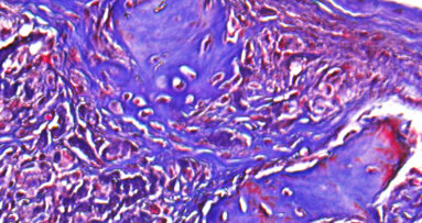 New hydrogel shows promise in dental and craniofacial tissue engineering