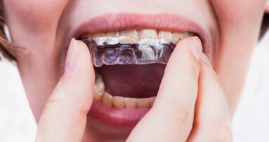 Three questions for Keith Batcheller, ClearCorrect