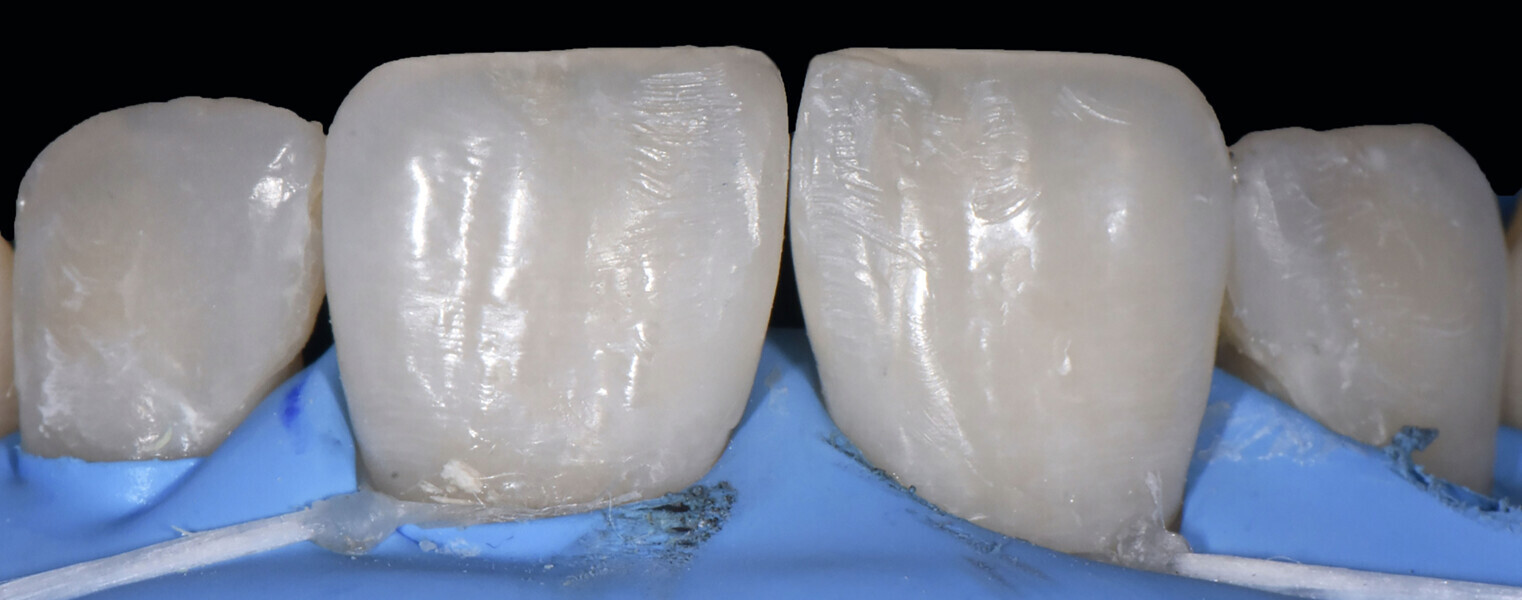 Fig. 13: Achievement of the surface texture.