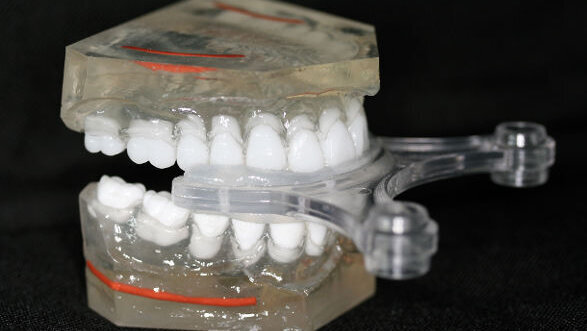 Use of an X-ray phantom in dental 3-D diagnostics in digital volume tomographs