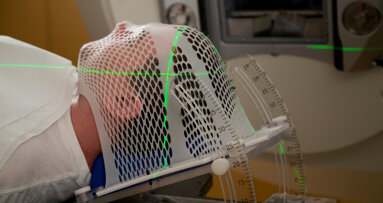 Good oral health associated with improved survival among head and neck cancer patients