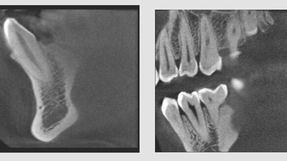 Suni Medical Imaging announces 3-D-only cone beam system