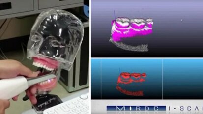 Taiwan: Apresentada nova relação custo-benefício da tecnologia de digitalização intraoral de laser azul