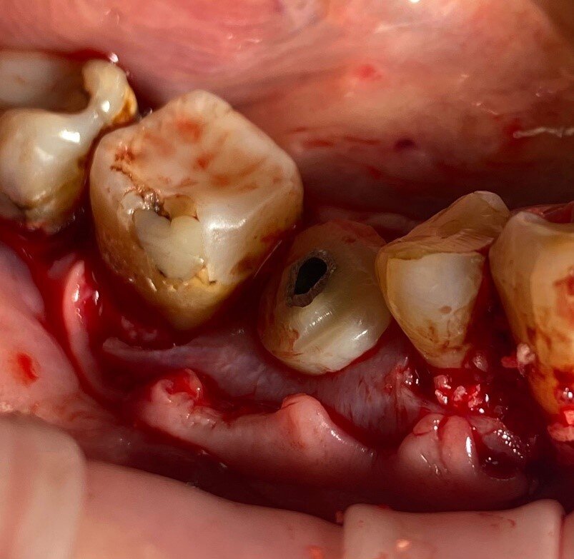 Fig. 14_Composito lamina-moncone in situ.