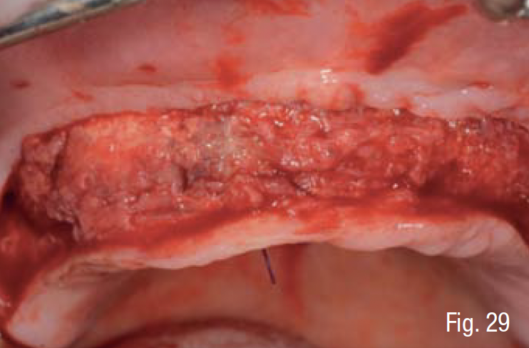 Fig. 29