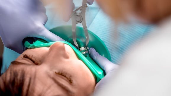 Зъболекар обвинен в смъртта на пациент след опит да извади 20 зъба