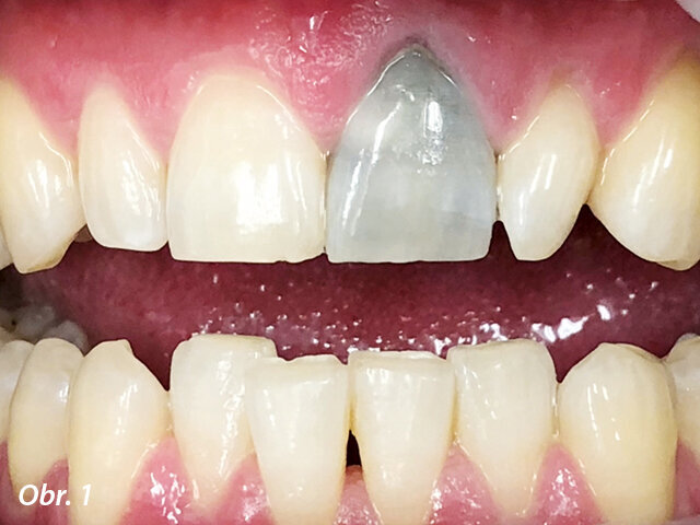 Obr. 1: Před ošetřením