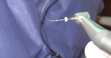 Endodontic follow-up in strongly curved root canals