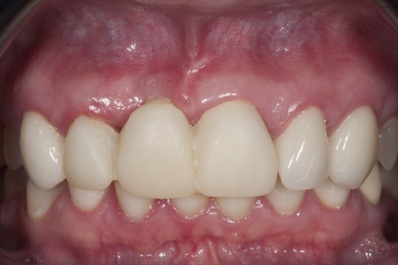 Ryc. 1_Stan pierwotny.