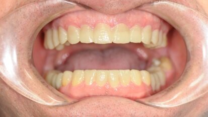 Interdyscyplinarne planowanie leczenia w stomatologii estetycznej