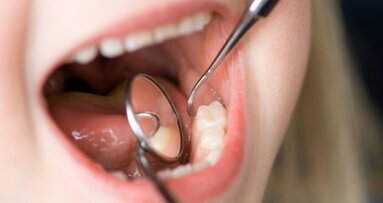 Parodontalerkrankungen im Kindheitsalter oft tragisch