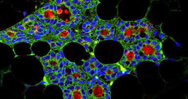 Dentale Stammzellen können milchproduzie­rende Zellen erzeugen