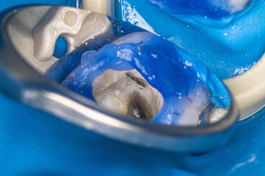 Fig. 18: First removed piece of the broken file.