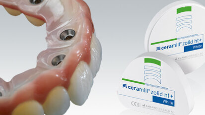 Ceramill Zolid HT+ – perfekcyjna symbioza estetyki i wytrzymałości