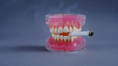 Проучване сравнява влиянието на електронните и обикновените цигари, наргилето и бездимния тютюн върху зъбните импланти