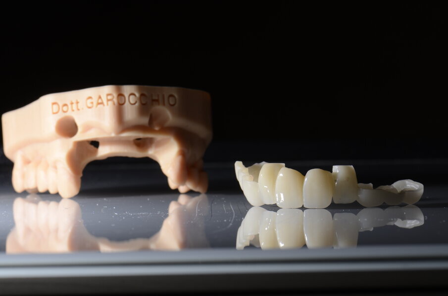 Fig. 21 - Modello Master e provvisorio pre-chirurgico.
