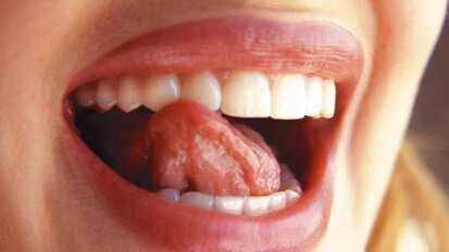 Braucht Ästhetik wirklich High-End-Technik?