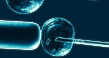 Dental pulp cells for stem cell banking