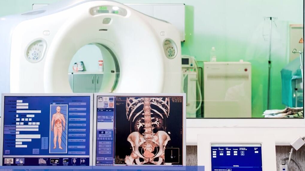 Efikasnost terapije svetlošću u tretmanu oralnog mukozitisa