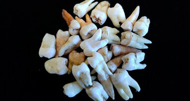 Sotto lo smalto… manca la vitamina D