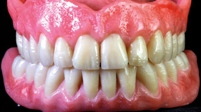 Protesi rimovibile: igiene, funzione, estetica