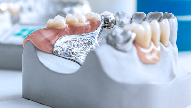 Zahntechniker-Handwerk mit niedrigem Umsatzplus