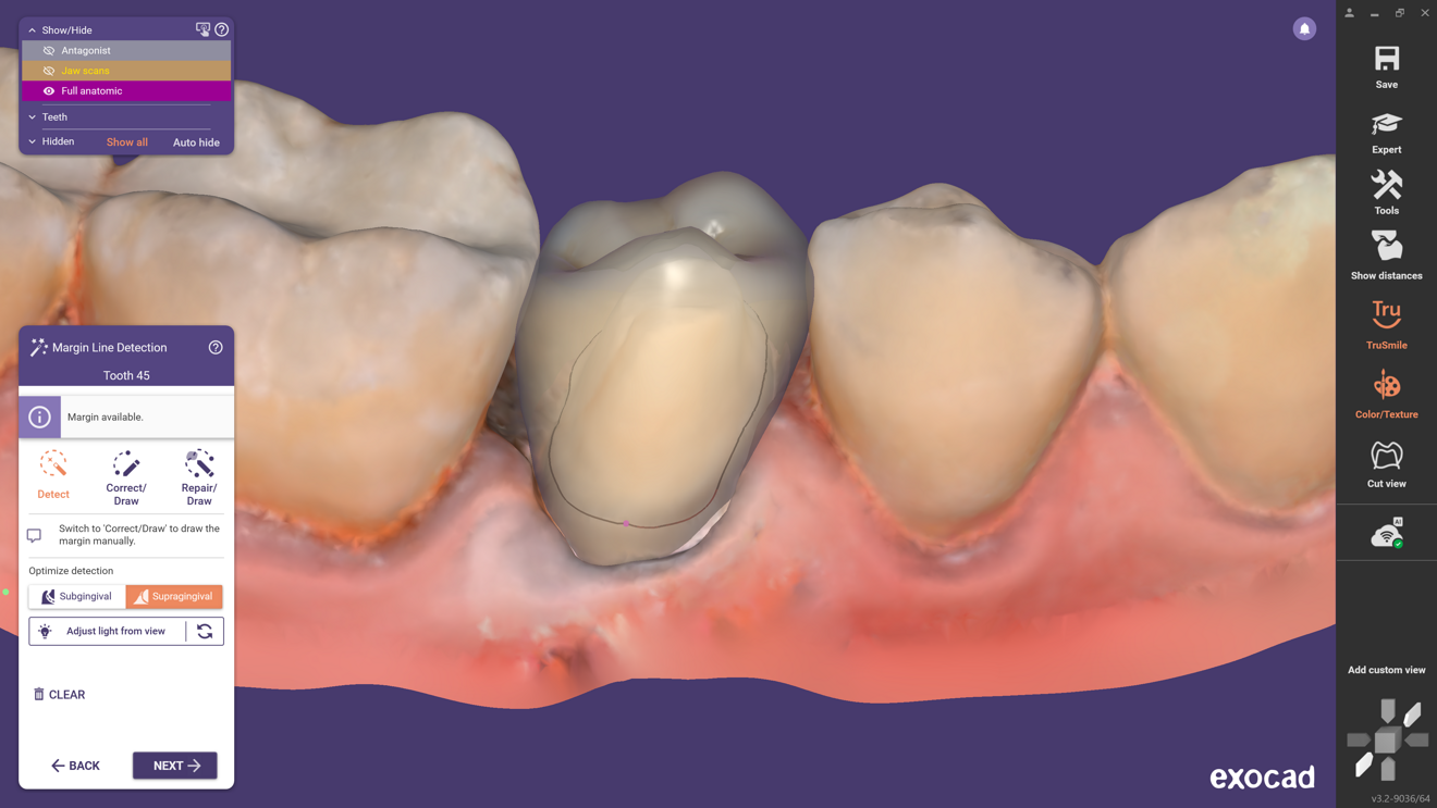 Fig. 7: User feedback is reviewed by the exocad team and is used to improve the software.